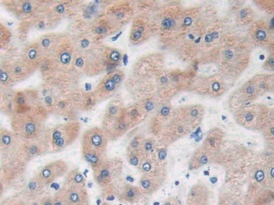 Ras Homolog Gene Family, Member Q (RHOQ) Human Polyclonal Antibody