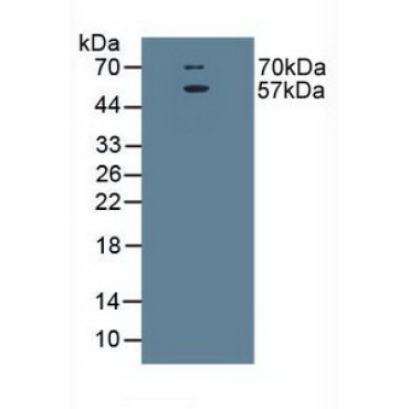 Excitatory Amino Acid Transporter 3 (EAAT3) Human Polyclonal Antibody