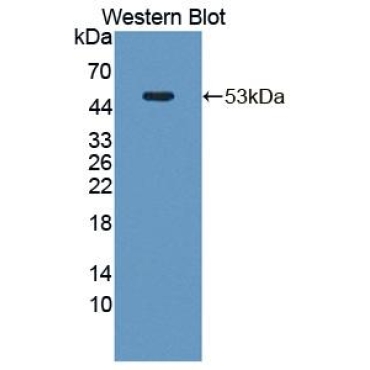 Solute Carrier Family 1, Member 5 (SLC1A5) Human Polyclonal Antibody