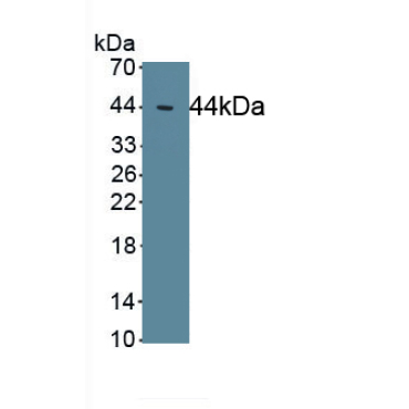 Excitatory Amino Acid Transporter 2 (EAAT2) Human Polyclonal Antibody