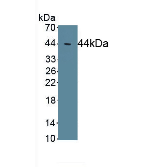 Excitatory Amino Acid Transporter 2 (EAAT2) Human Polyclonal Antibody
