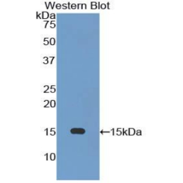 Glucose Transporter 14 (GLUT14) Human Polyclonal Antibody