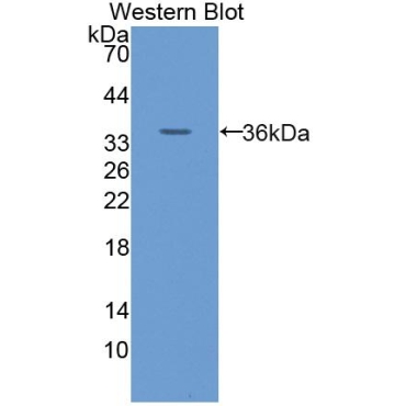 Glucose Transporter 14 (GLUT14) Human Polyclonal Antibody