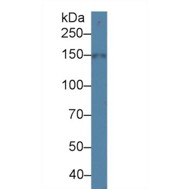Na-Cl Cotransporter (NCCT) Human Polyclonal Antibody