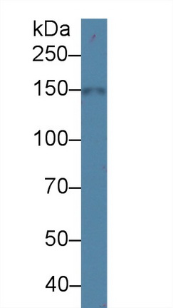 Na-Cl Cotransporter (NCCT) Human Polyclonal Antibody