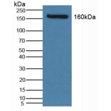Na-Cl Cotransporter (NCCT) Human Polyclonal Antibody