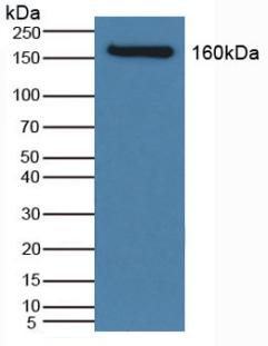 Na-Cl Cotransporter (NCCT) Human Polyclonal Antibody