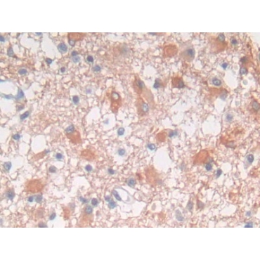 Fyn Related Kinase (FRK) Human Polyclonal Antibody