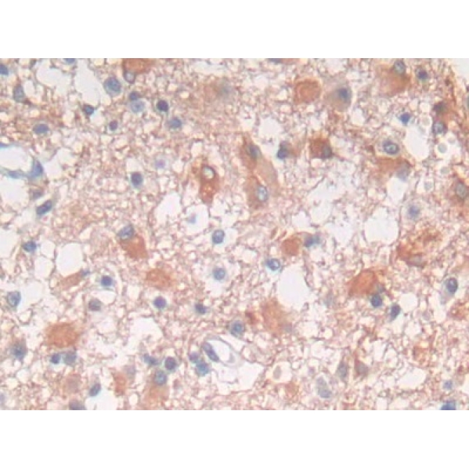Fyn Related Kinase (FRK) Human Polyclonal Antibody