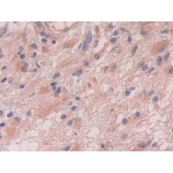 Anion/Sugar Transporter (AST) Human Polyclonal Antibody