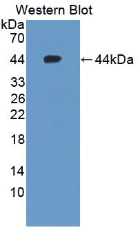 Sodium Iodide Symporter (NIS) Human Polyclonal Antibody