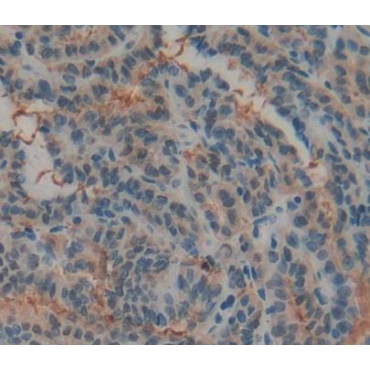 Hydrogen Ion/Peptide Transporter 1 (HPEPT1) Human Polyclonal Antibody