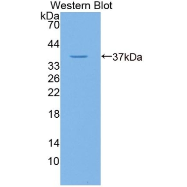 Gibbon Ape Leukemia Virus Receptor 1 (GLVR1) Human Polyclonal Antibody