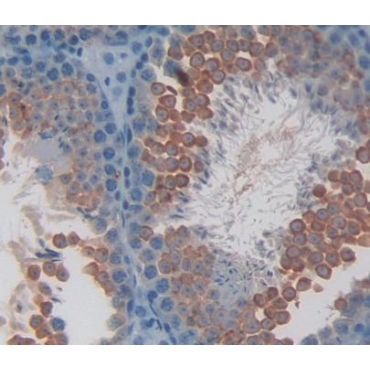 Gibbon Ape Leukemia Virus Receptor 1 (GLVR1) Mouse Polyclonal Antibody