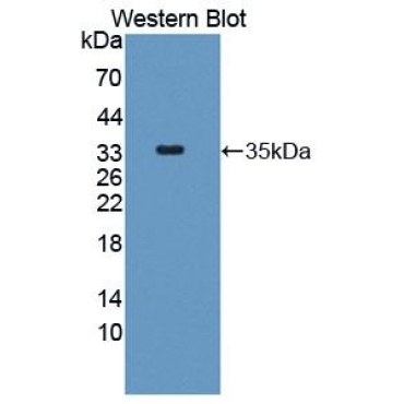 Mitoferrin (MFRN) Human Polyclonal Antibody