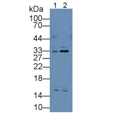Electron Transfer Flavoprotein Alpha Polypeptide (ETFa) Human Polyclonal Antibody