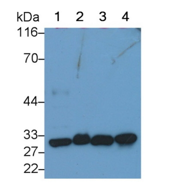 Phosphoglycerate Mutase 1, Brain (PGAM1) Human Polyclonal Antibody