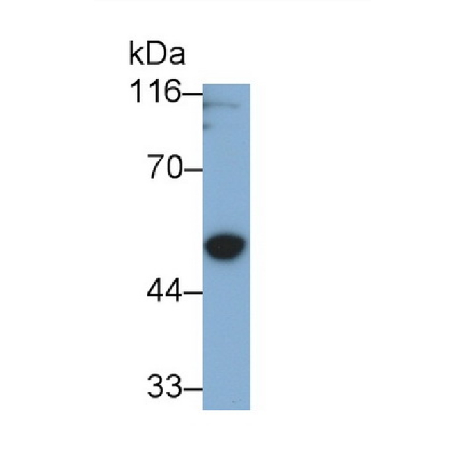 Gasdermin D (GSDMD) Human Polyclonal Antibody