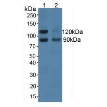 Neural Cell Adhesion Molecule 2 (NCAM2) Human Polyclonal Antibody