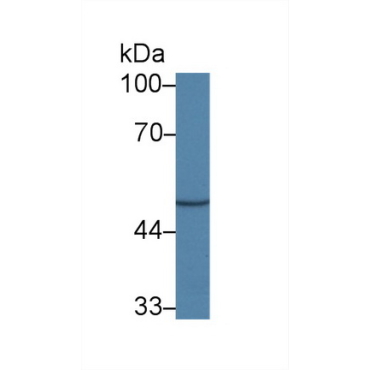 Cell Adhesion Molecule 1 (CADM1) Human Polyclonal Antibody