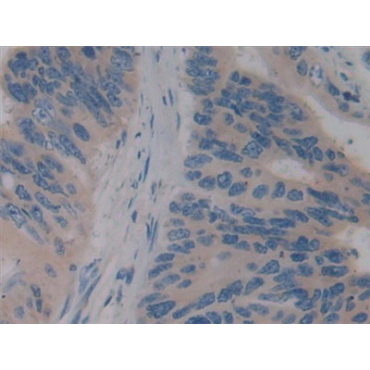 Glycoprotein 2, Zymogen Granule Membrane (GP2) Human Polyclonal Antibody