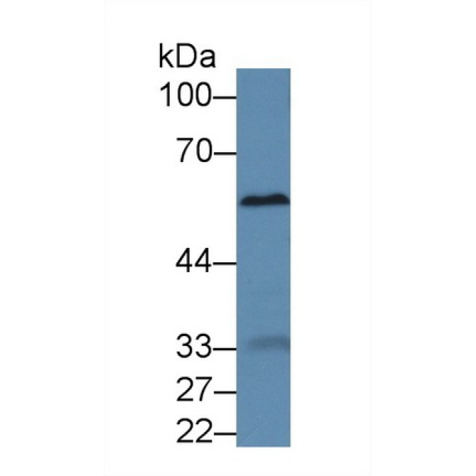 Alpha-1-B-Glycoprotein (a1BG) Mouse Polyclonal Antibody