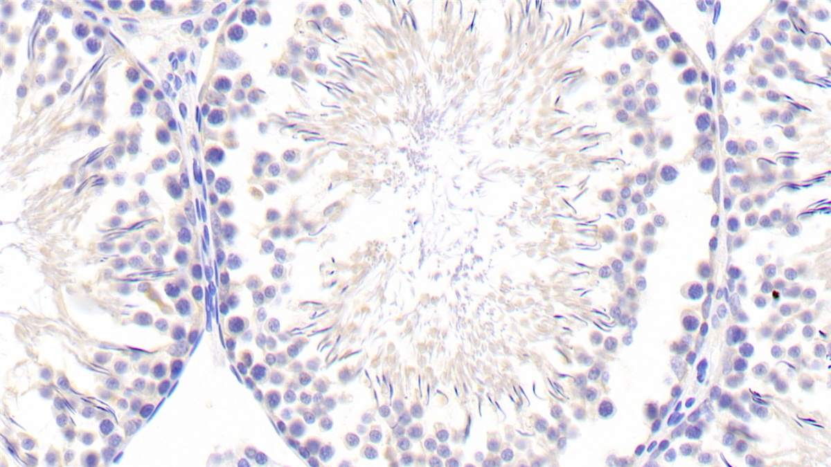 Alpha-1-B-Glycoprotein (a1BG) Rat Polyclonal Antibody