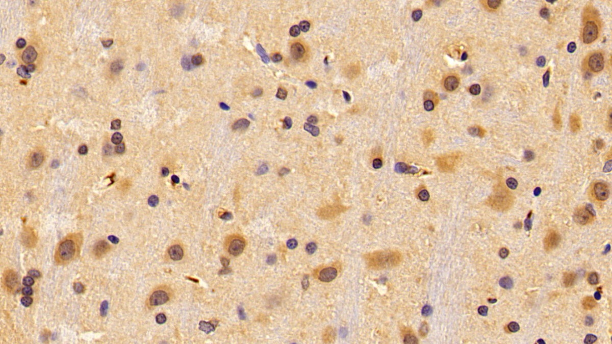 Alpha-1-B-Glycoprotein (a1BG) Rat Polyclonal Antibody
