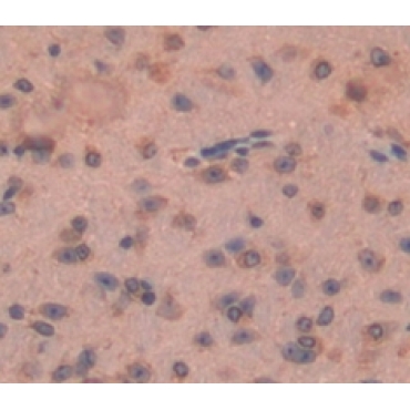 Frizzled Homolog 1 (FZD1) Mouse Polyclonal Antibody
