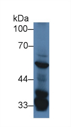 Serum/Glucocorticoid Regulated Kinase 3 (SGK3) Mouse Polyclonal Antibody