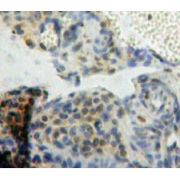 B-Cell CLL/Lymphoma 9 (Bcl9) Human Polyclonal Antibody