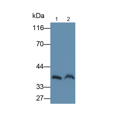 B-Cell CLL/Lymphoma 7A (Bcl7A) Human Polyclonal Antibody