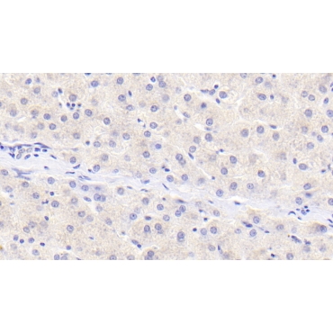 Protein Inhibitor Of Activated STAT 3 (PIAS3) Human Polyclonal Antibody