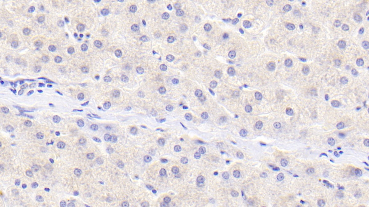 Protein Inhibitor Of Activated STAT 3 (PIAS3) Human Polyclonal Antibody