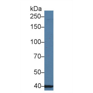 Ubiquitin Associated Protein 2 (UBAP2) Human Polyclonal Antibody