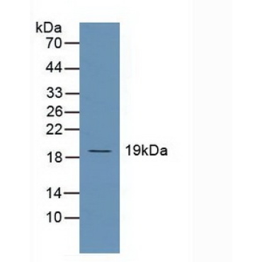 Ubiquitin Conjugating Enzyme E2C (UBE2C) Human Polyclonal Antibody