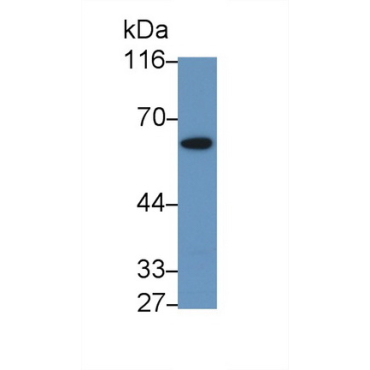 Cyclin Dependent Kinase 16 (CDK16) Human Polyclonal Antibody