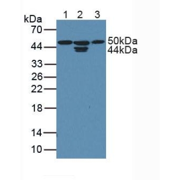 Cyclin Dependent Kinase 18 (CDK18) Human Polyclonal Antibody