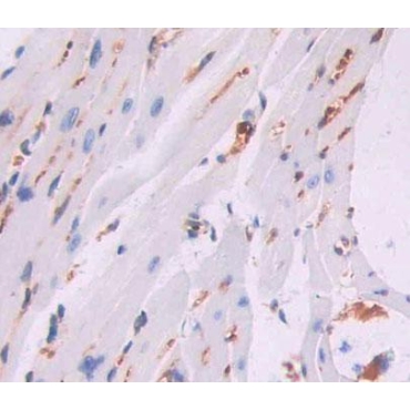 Cyclin Dependent Kinase 20 (CDK20) Mouse Polyclonal Antibody