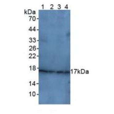 Cyclin Dependent Kinase Inhibitor 1A (CDKN1A) Human Polyclonal Antibody