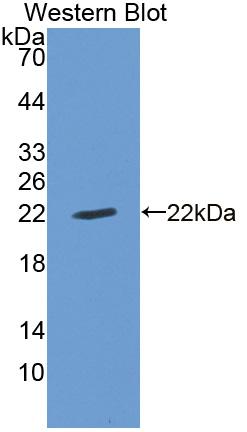 Cyclin Dependent Kinase Inhibitor 1A (CDKN1A) Rat Polyclonal Antibody