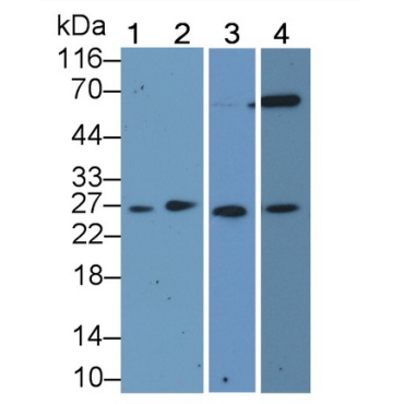Cyclin Dependent Kinase Inhibitor 1B (CDKN1B) Human Polyclonal Antibody