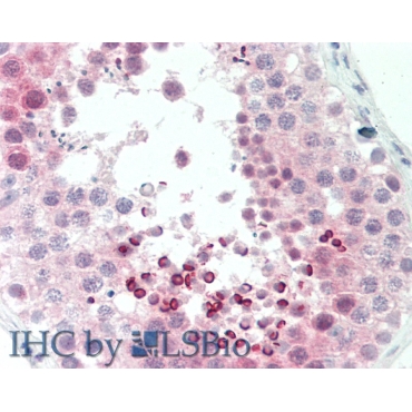 Cyclin Dependent Kinase Inhibitor 2D (CDKN2D) Human Polyclonal Antibody
