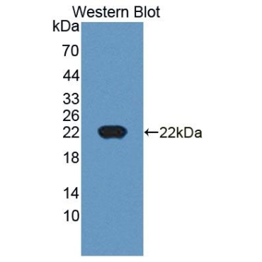 Cyclin Dependent Kinase Inhibitor 2D (CDKN2D) Mouse Polyclonal Antibody