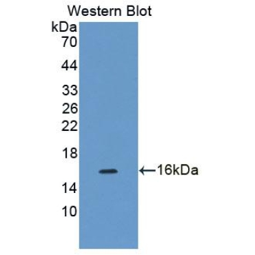 Cyclin Dependent Kinase 2 Associated Protein 1 (CDK2AP1) Human Polyclonal Antibody
