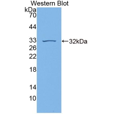 Guanylate Binding Protein 7 (GBP7) Human Polyclonal Antibody