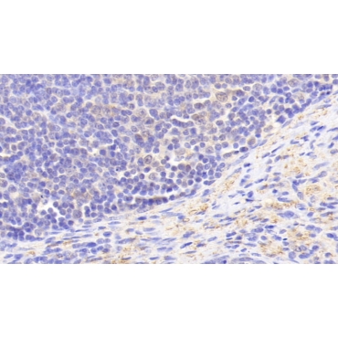 Guanylate Binding Protein 5 (GBP5) Human Polyclonal Antibody