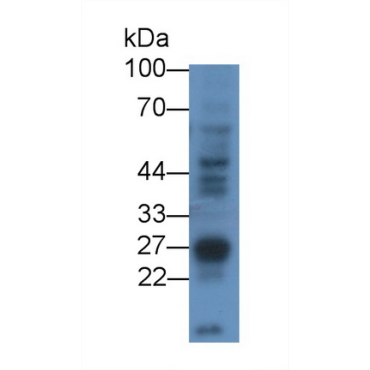 Receptor Interacting Serine Threonine Kinase 3 (RIPK3) Human Polyclonal Antibody