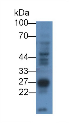 Receptor Interacting Serine Threonine Kinase 3 (RIPK3) Human Polyclonal Antibody