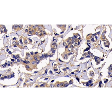 Receptor Interacting Serine Threonine Kinase 1 (RIPK1) Human Polyclonal Antibody